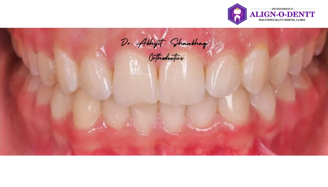 After treatment
